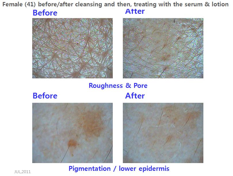 before_after cosmetics.jpeg